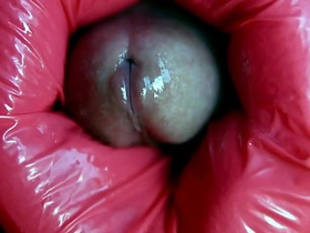 Big dick stuck all round hole www asian gay sex videos