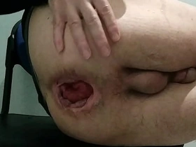 Showing my ass after 300 anal videos with an increment of a unmitigatedly hard anal insertion male delighted coition porn videos asian